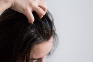 Домашние средства от жирной кожи головы: 10 натуральных способов борьбы с жирностью кожи головы и волос
